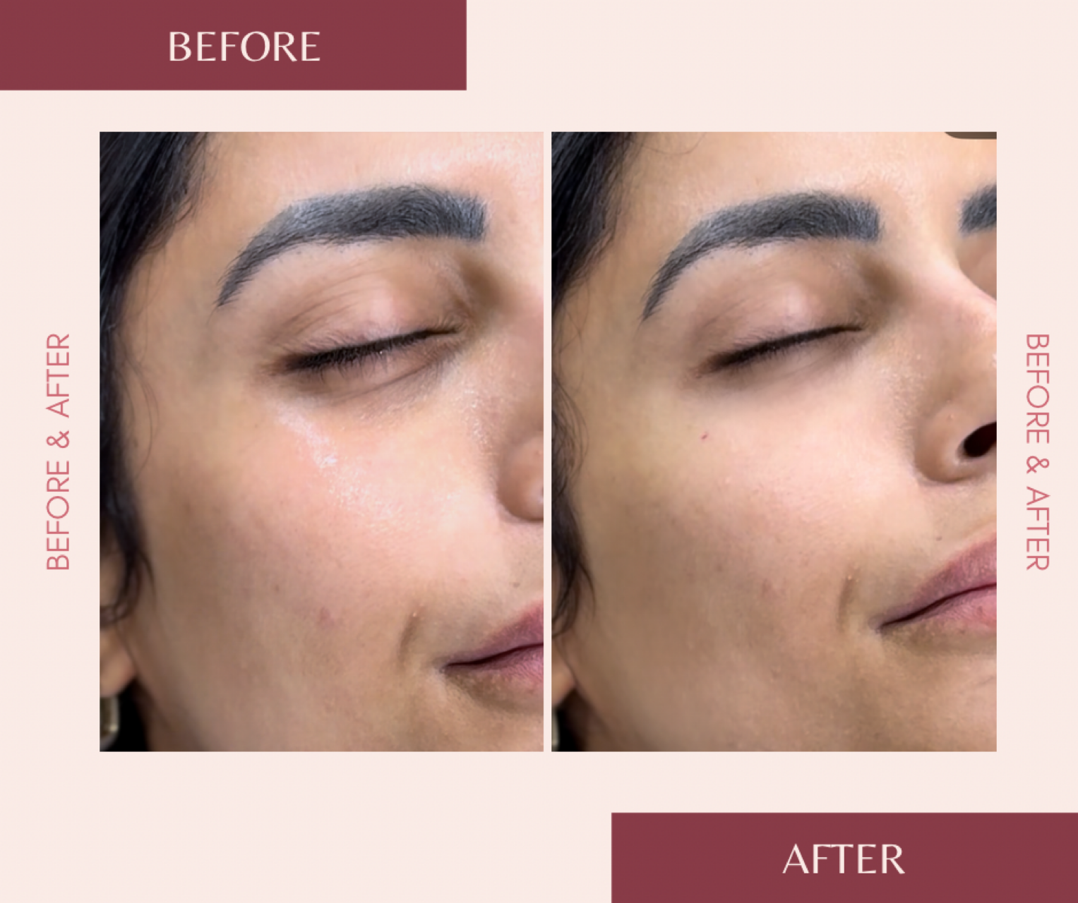Before & After Results | Roena Med Spa Cerritos